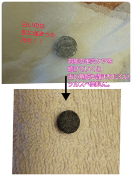 【フェイシャル】溜まる角質！しっかり除去