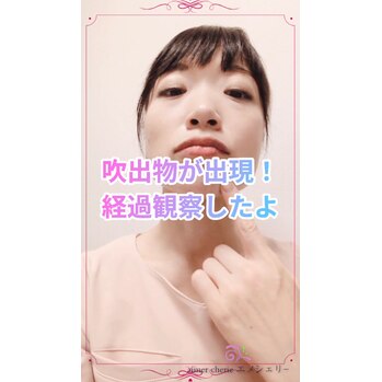 吹出物出現その2